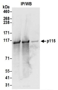 Rabbit p115 Antibody