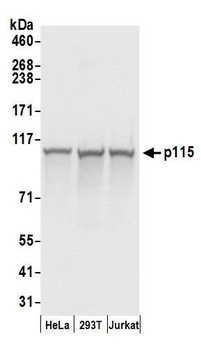 Rabbit p115 Antibody