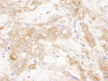 Rabbit CHMP2B Antibody