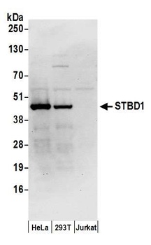 Rabbit STBD1 Antibody