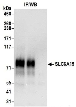 Rabbit SLC6A15 Antibody