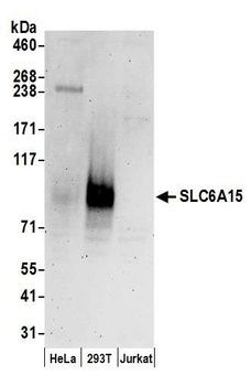 Rabbit SLC6A15 Antibody