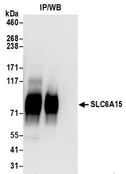 Rabbit SLC6A15 Antibody