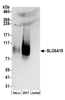 Rabbit SLC6A15 Antibody