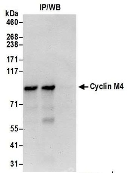Rabbit Cyclin M4 Antibody