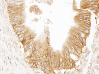 Rabbit AC9 Antibody