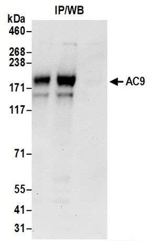 Rabbit AC9 Antibody