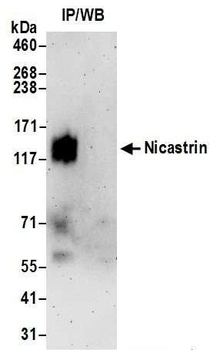 Rabbit Nicastrin Antibody
