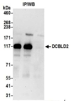 Rabbit DCBLD2 Antibody