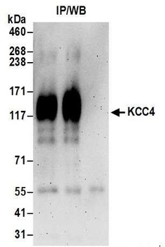 Rabbit KCC4 Antibody