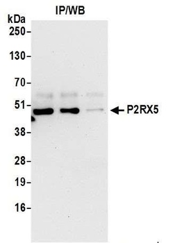Rabbit P2RX5 Antibody