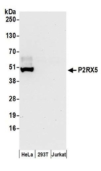 Rabbit P2RX5 Antibody