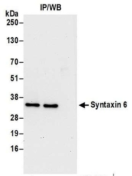 Rabbit Syntaxin 6 Antibody