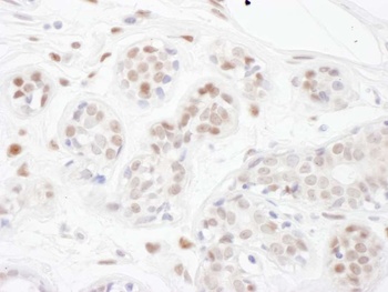 Rabbit PINX1 Antibody