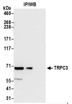 Rabbit TRPC3 Antibody