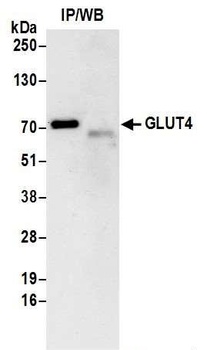 Rabbit anti-GLUT4 Antibody