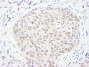 Rabbit TDG Antibody