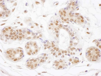 Rabbit TDG Antibody