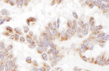 Rabbit Presenilin-2 Antibody