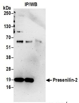 Rabbit Presenilin-2 Antibody