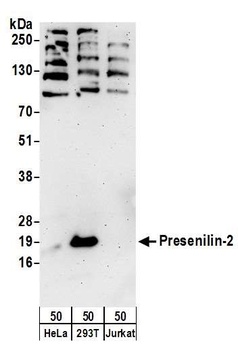 Rabbit Presenilin-2 Antibody