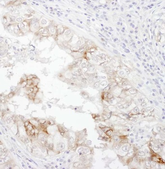 Rabbit CD98 Antibody