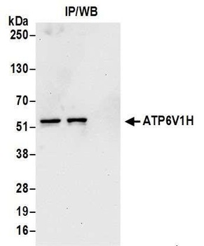 Rabbit ATP6V1H Antibody