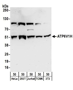 Rabbit ATP6V1H Antibody