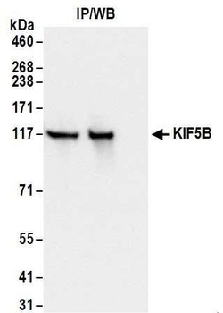Rabbit KIF5B Antibody