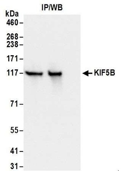 Rabbit KIF5B Antibody
