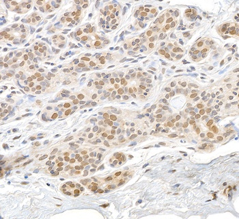 Rabbit RAN Antibody
