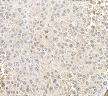 Rabbit RAN Antibody