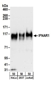 Rabbit anti-IFNAR1 Antibody