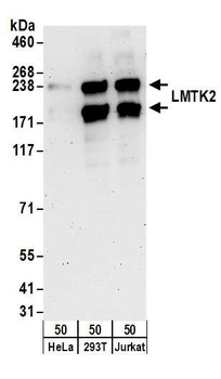 Rabbit LMTK2 Antibody