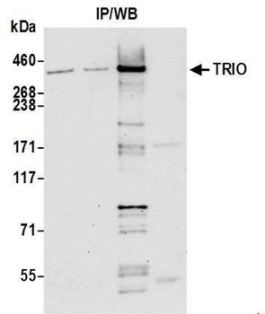 Rabbit TRIO Antibody