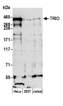 Rabbit TRIO Antibody