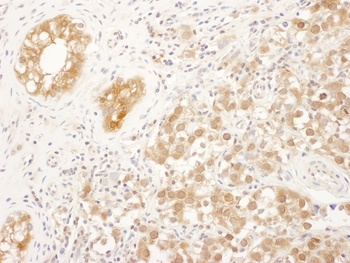 Rabbit FNTA Antibody
