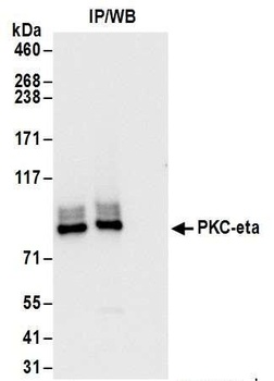 Rabbit PKC-eta Antibody