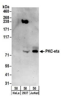 Rabbit PKC-eta Antibody