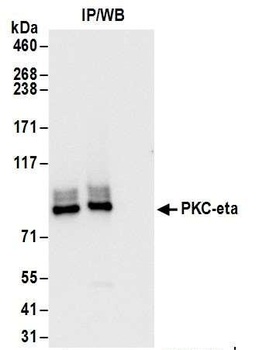 Rabbit PKC-eta Antibody