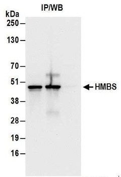 Rabbit HMBS Antibody