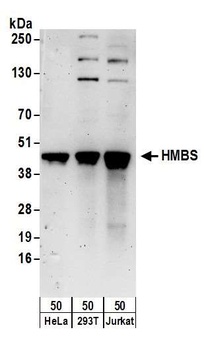 Rabbit HMBS Antibody