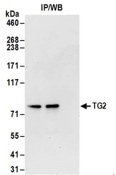 Rabbit TG2 Antibody