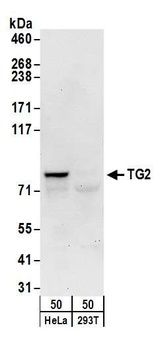Rabbit TG2 Antibody