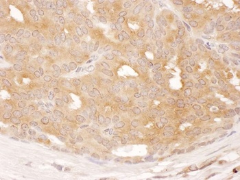 Rabbit DYNC1LI1 Antibody