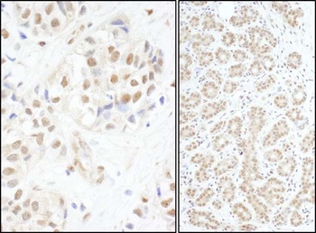 Rabbit c-Myb Antibody