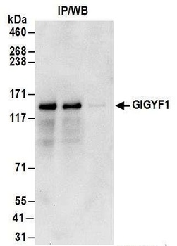 Rabbit GIGYF1 Antibody