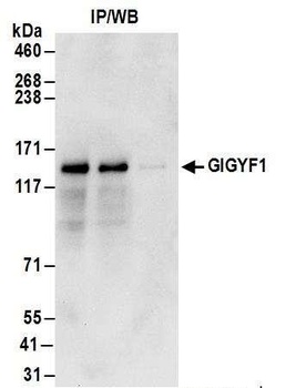 Rabbit GIGYF1 Antibody