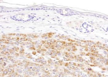 Rabbit IDH2 Antibody