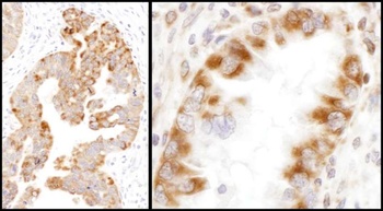 Rabbit IDH2 Antibody